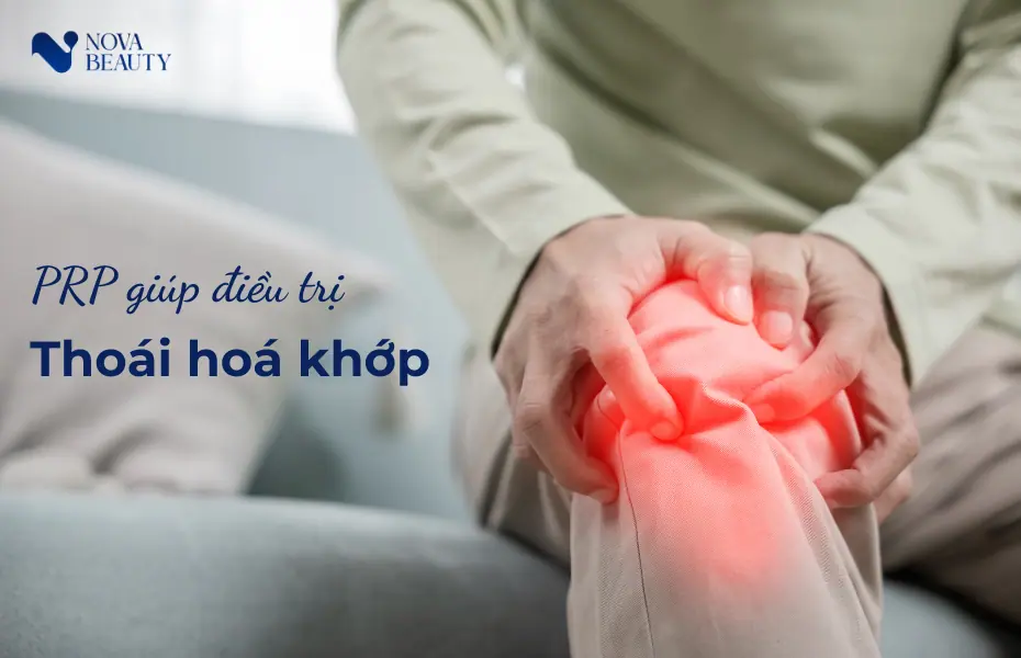 PRP trong điều trị thoái hóa khớp
