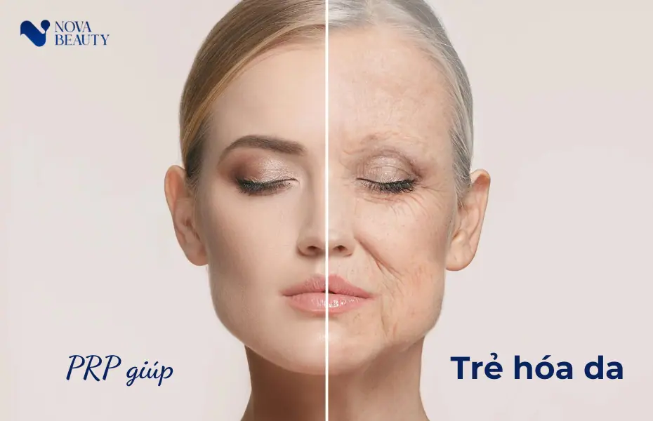 PRP trong việc trẻ hóa da