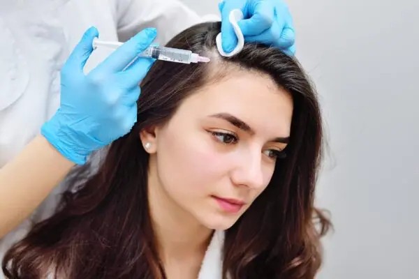 Ứng dụng của PRP trong điều trị rụng tóc - hói đầu
